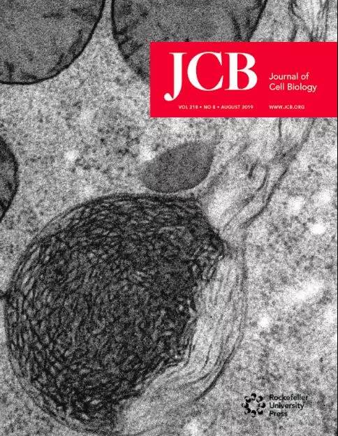jcb封面:吞噬溶酶体再形成的电镜图片